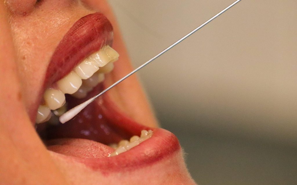 DNA Cheek Swab